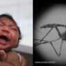 Kothrud Zika Virus Symptoms Reported in Erandwane Area